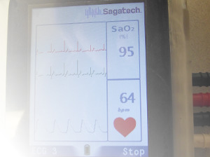 Wireless Electocardiography